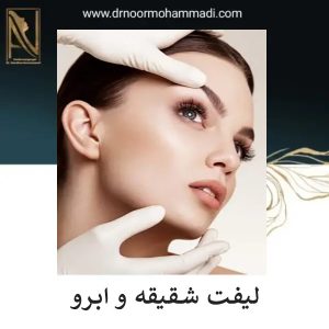 لیفت شقیقه و ابرو در تهران | دکتر احمدرضا نورمحمدی
