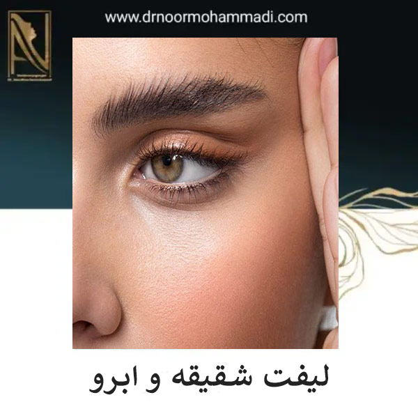 عمل لیفت شقیقه و ابرو در تهران | دکتر احمدرضا نورمحمدی