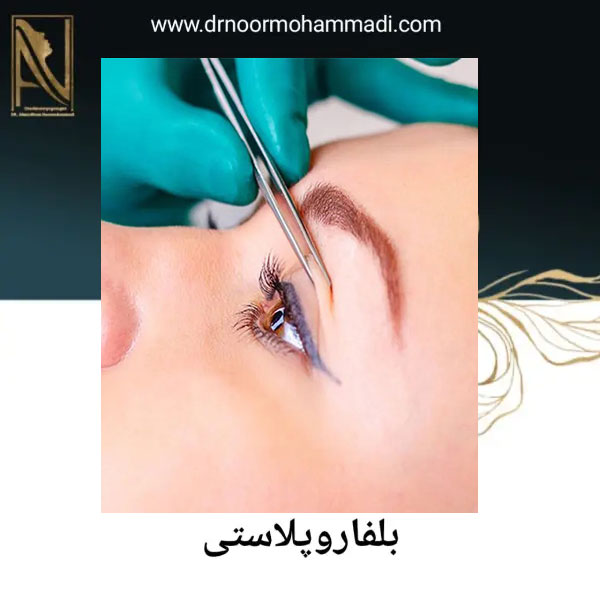 جراحی زیبایی پلک _دکتر احمدرضا نورمحمدی