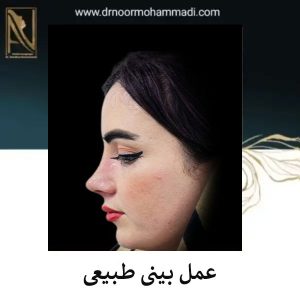 عمل بینی طبیعی در تهران _ دکتر احمدرضا نورمحمدی