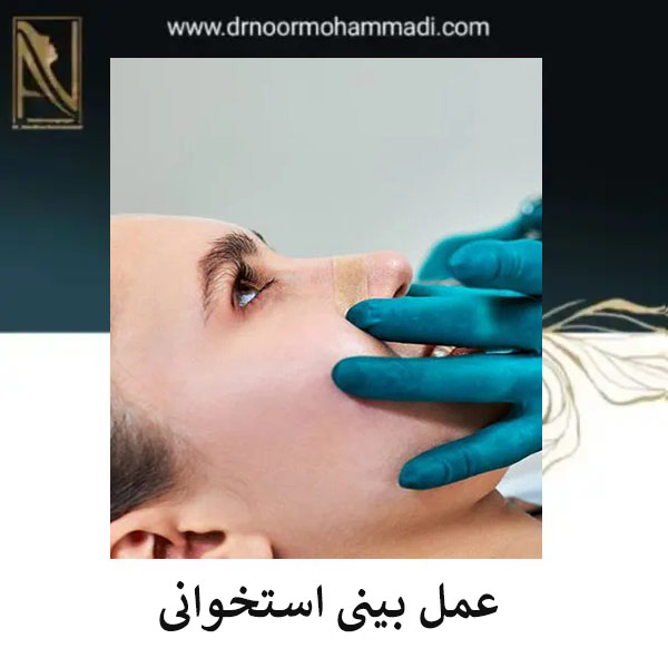 عمل بینی استخوانی در تهران _ دکتر احدرضا نورمحمدی