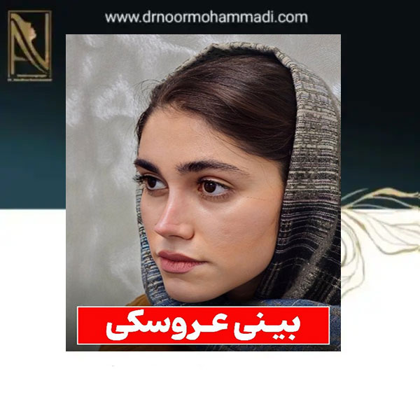 نمونه کار بهترین جراح بینی تهران _ دکتر احمدرضا نورمحمدی
