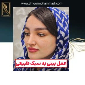 نمونه عمل بهترین جراح بینی تهران _ دکتر احمدرضا نورمحمدی