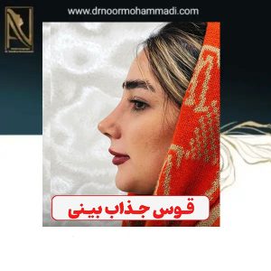نمونه کار بهترین دکتر عمل بینی تهران _ دکتر احمدرضا نورمحمدی