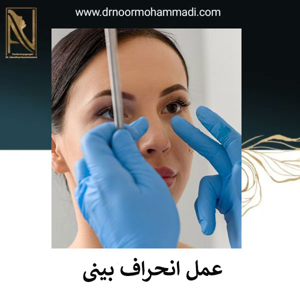 جراحی انحراف بینی _ دکتر احمدرضا نورمحمدی
