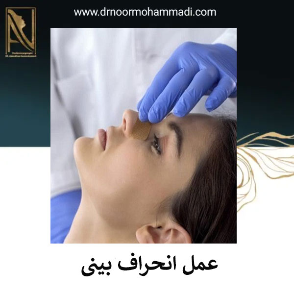 عمل انحراف بینی _ دکتر احمدرضا نورمحمدی