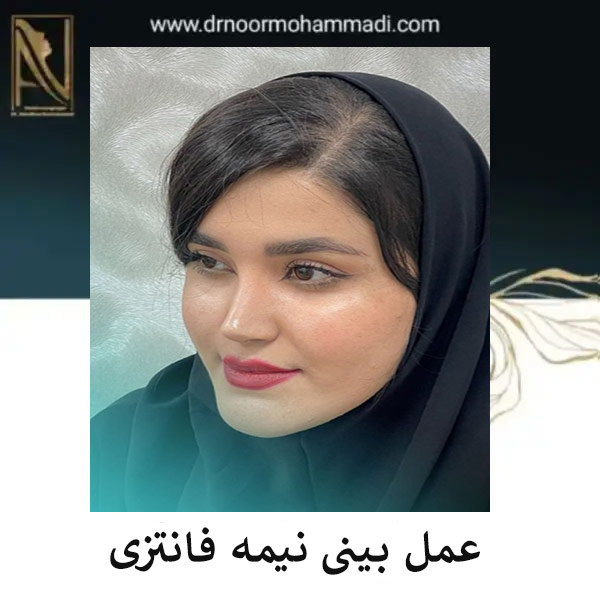 عمل بینی نیمه فانتزی _ دکتر احمدرضا نورمحمدی