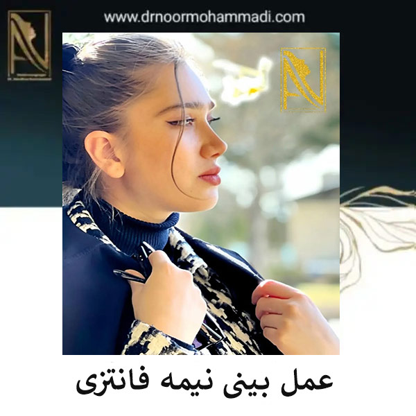 جراحی بینی نیمه عروسکی _ دکتر احمدرضا نورمحمدی