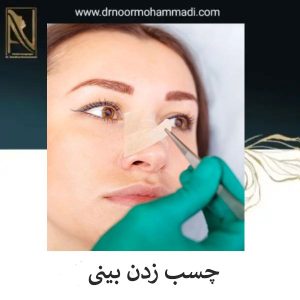 چسب زدن بینی بعد از جراحی _ دکتر احمدرضا نورمحمدی