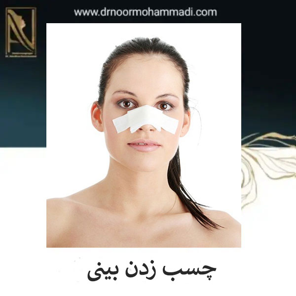 چسب زدن بینی بعد از رینوپلاستی _ دکتر احمدرضا نورمحمدی